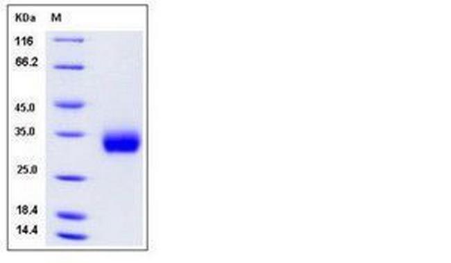 Human ULBP-2 His-tag Protein