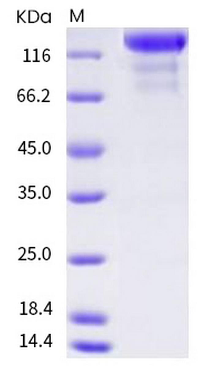 Human VEGFR3 (Flt-4) Fc Chimera Protein