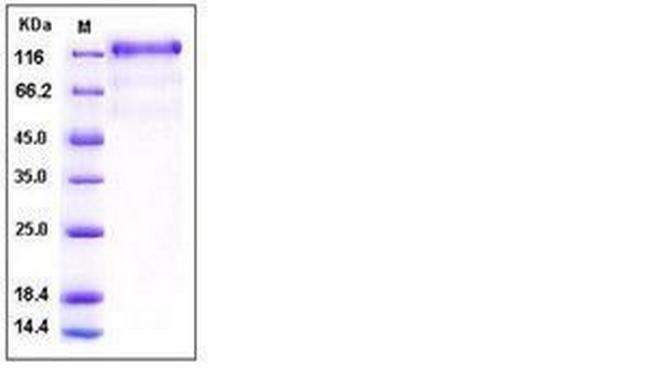 Human VEGFR3 (Flt-4) His-tag Protein