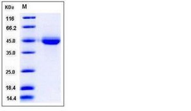 Human VSIG4 His-tag Protein