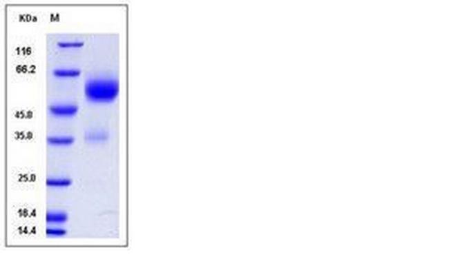 Human VSTM1 Fc Chimera Protein