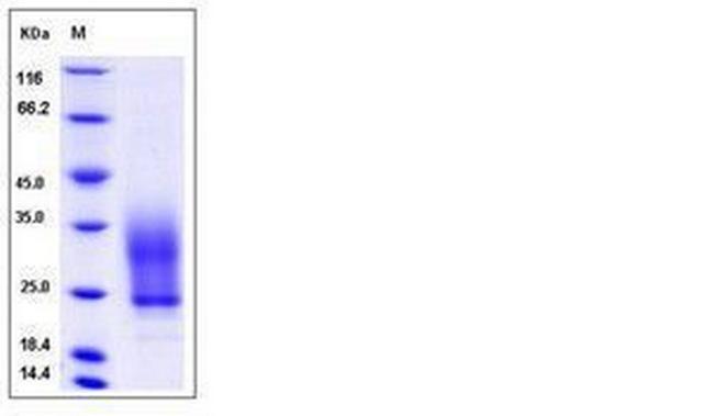 Human VSTM1 His-tag Protein