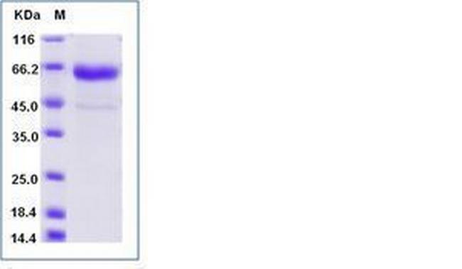 Influenza A H1N1 HA (A/California/04/2009) His-tag Protein