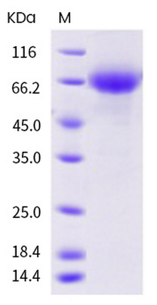 Influenza A H1N1 HA (A/Puerto Rico/8/1934) His-tag Protein