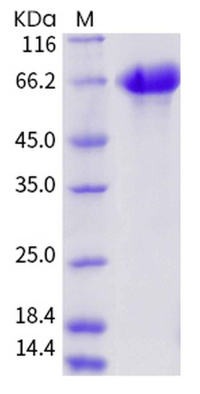 Influenza A H3N2 HA (A/Aichi/2/1968) His-tag Protein
