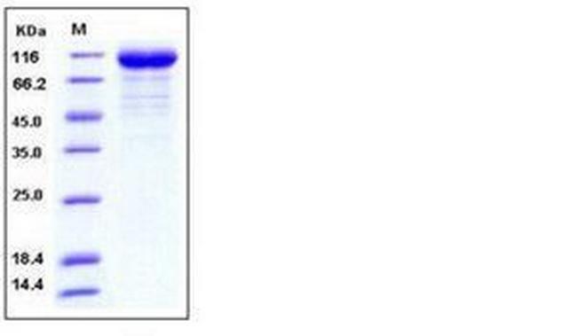 Influenza A H3N2 HA (A/Brisbane/10/2007) His-tag Protein