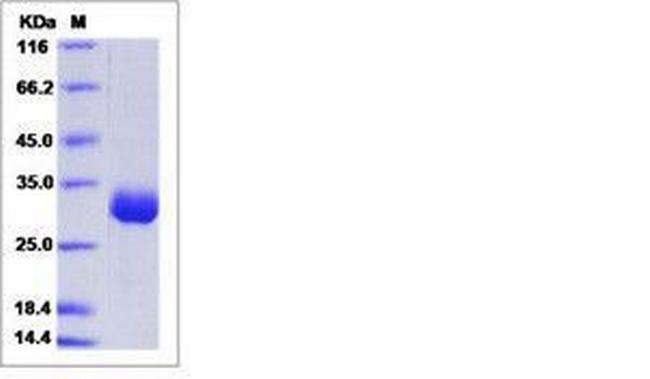 Mouse Angiopoietin-1 His-tag Protein