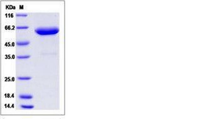 Mouse ANGPTL2 Fc Chimera Protein