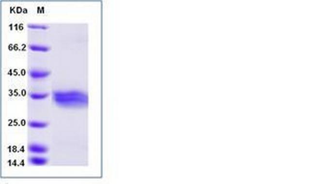 Mouse ANGPTL3 (aa 1-220) His-tag Protein