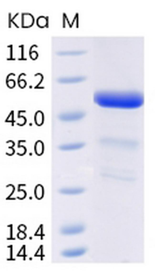 Mouse ANGPTL3 His-tag Protein