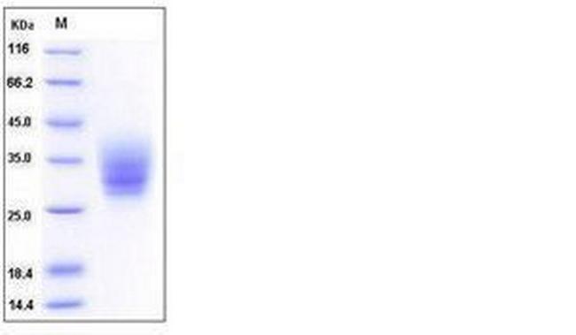Mouse EMMPRIN (CD147) His-tag Protein
