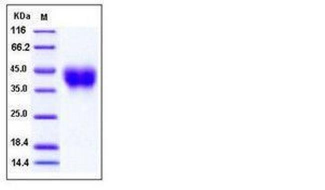 Mouse CD200 His-tag Protein