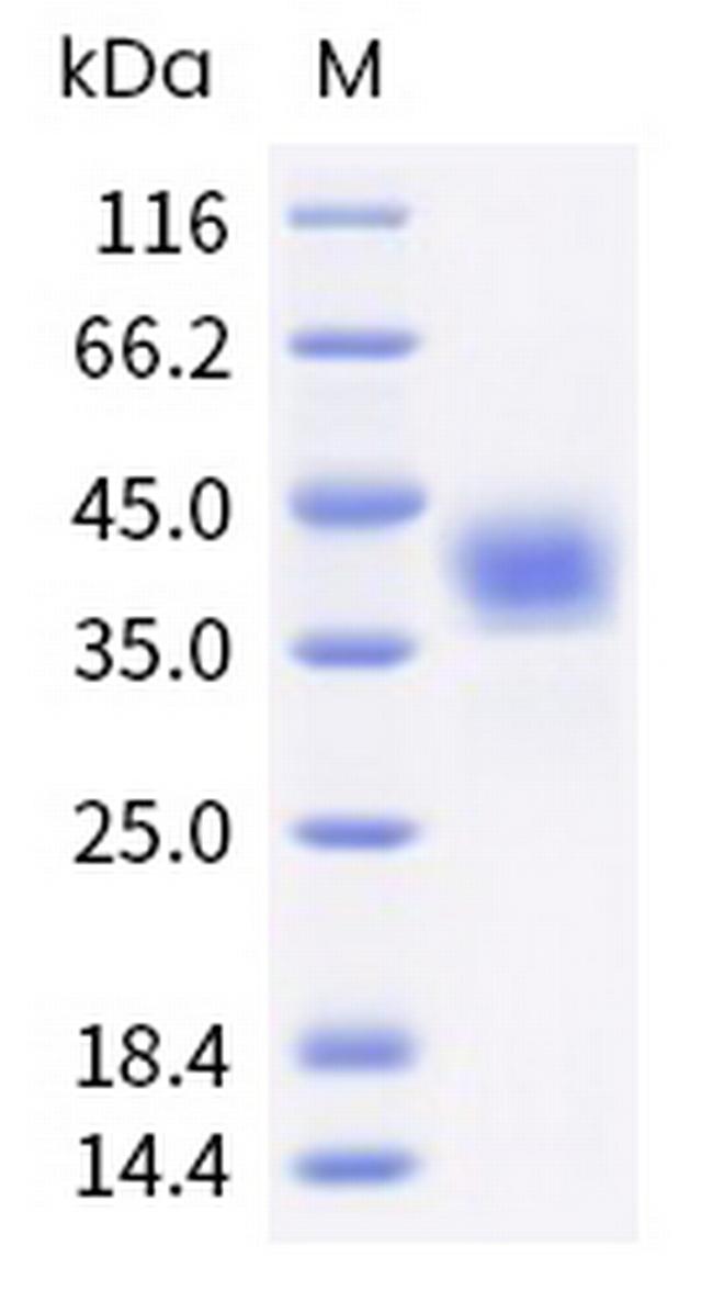 Mouse Siglec-3 (CD33) His-tag Protein