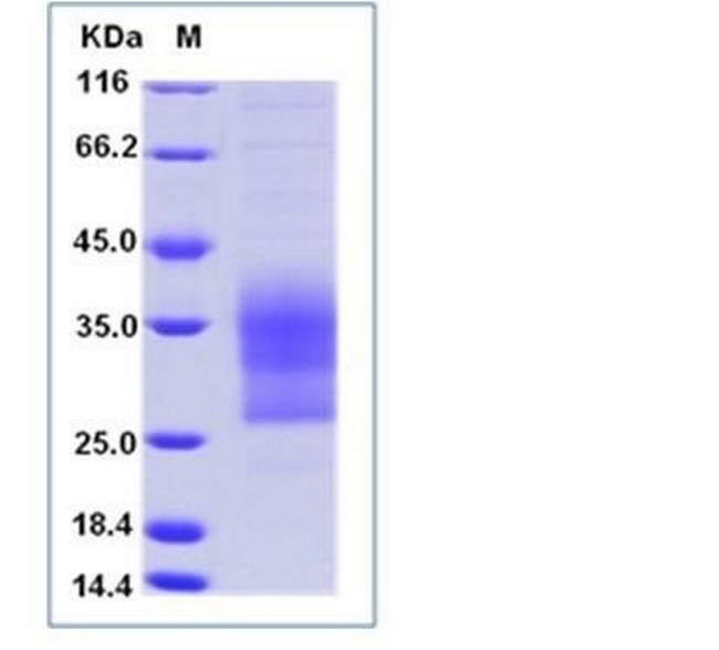 Mouse CD79b His-tag Protein