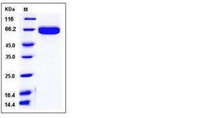 Mouse EphA2 His-tag Protein