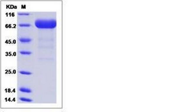 Mouse EphA3 His-tag Protein