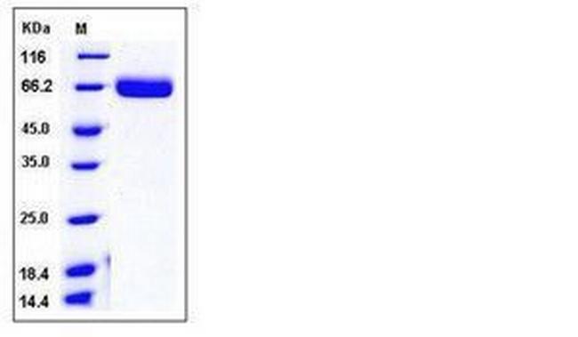 Mouse EphA4 His-tag Protein