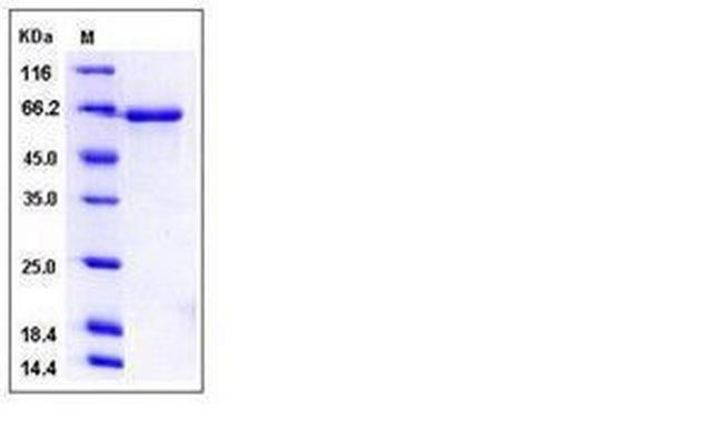 Mouse EphB3 His-tag Protein
