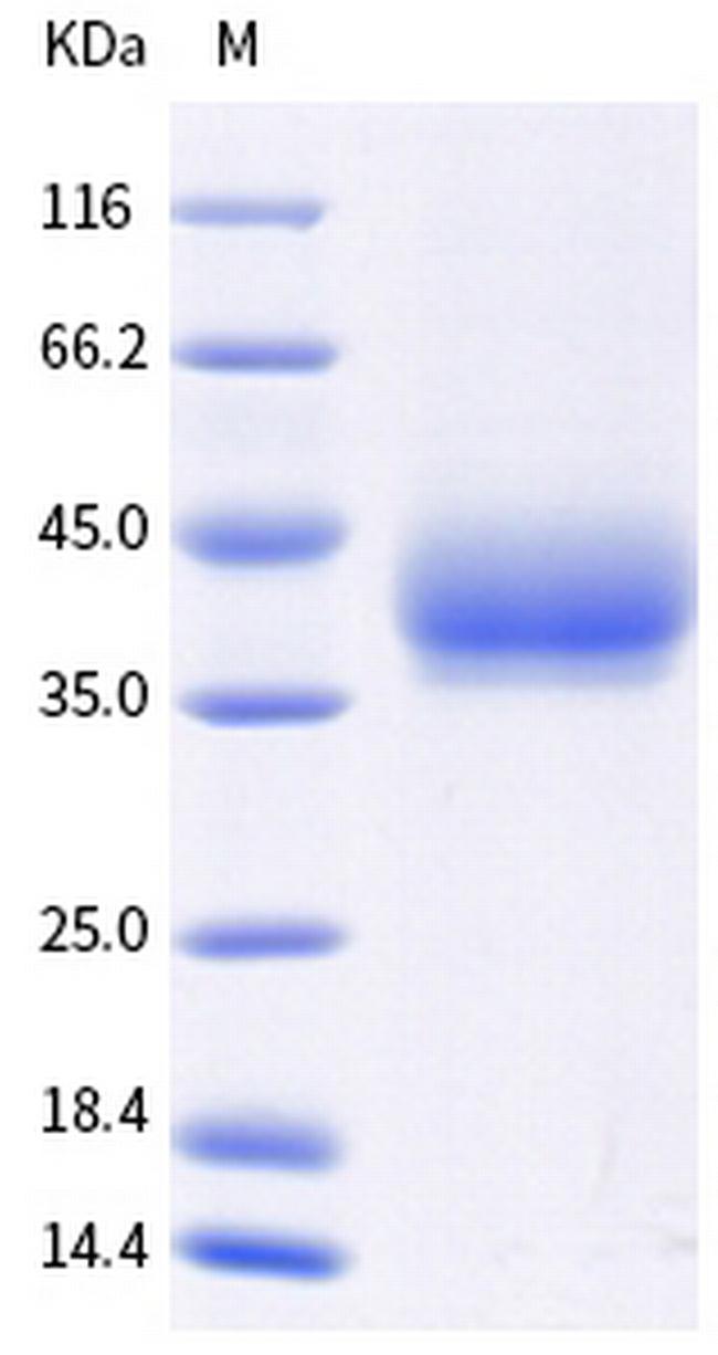 Mouse LILRB4 (CD85k, ILT3) His-tag Protein