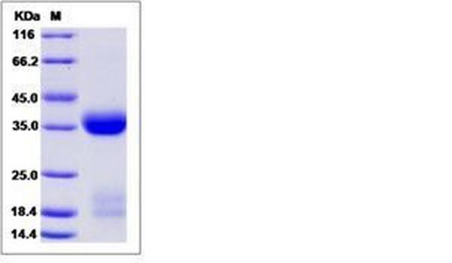 Mouse Kallikrein 1 His-tag Protein