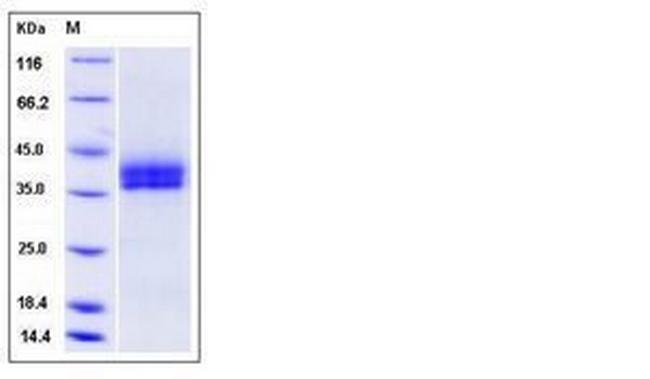 Mouse Kallikrein 11 His-tag Protein