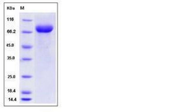 Mouse LILRB3 (CD85a, ILT5) His-tag Protein