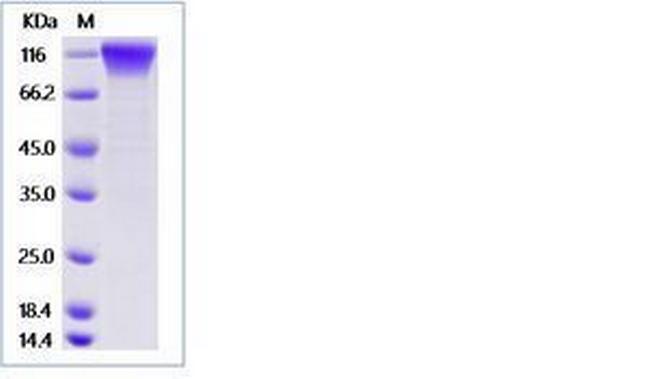 Mouse PDGFRA (CD140a) Fc Chimera Protein