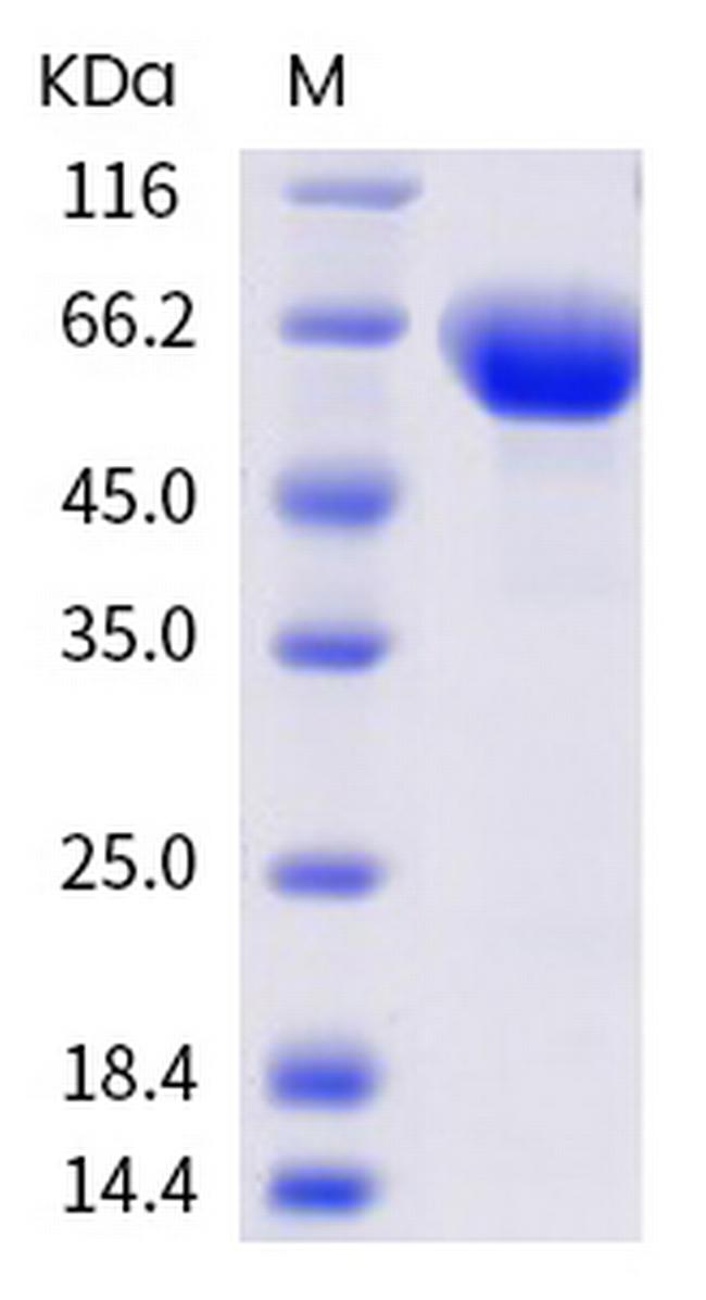 Mouse ROR1 His-tag Protein