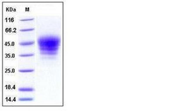 Mouse CRACC (SLAMF7) His-tag Protein