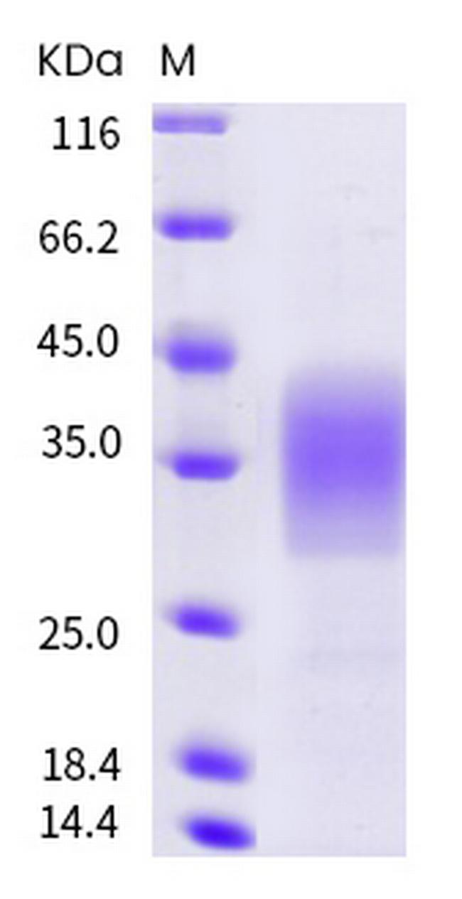 Mouse TREM-2 His-tag Protein