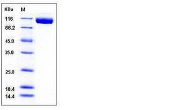 Mouse VEGFR3 (Flt-4) His-tag Protein