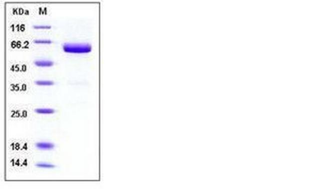 Mouse VSIG4 Fc Chimera His-tag Protein