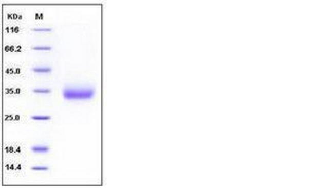 Mouse VSIG4 His-tag Protein