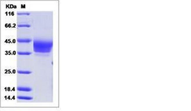 Rat B7-H6 His-tag Protein