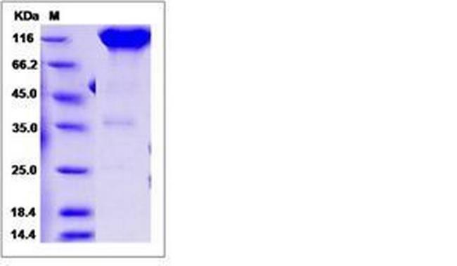Rat PDGFRA (CD140a) Fc Chimera Protein