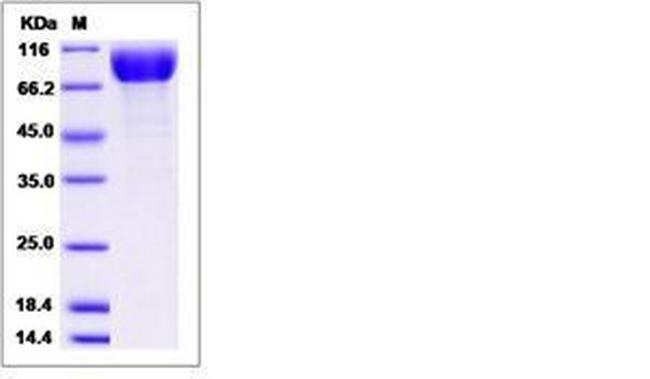 Rat PDGFRA (CD140a) His-tag Protein