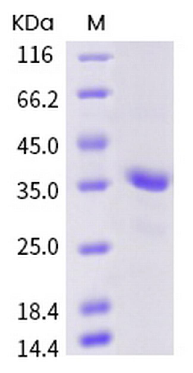 SARS-COV-2 3CL Protease His-Avi Tag Protein