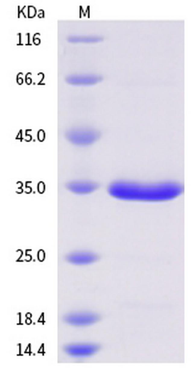 SARS 3CL Protease His-tag Protein