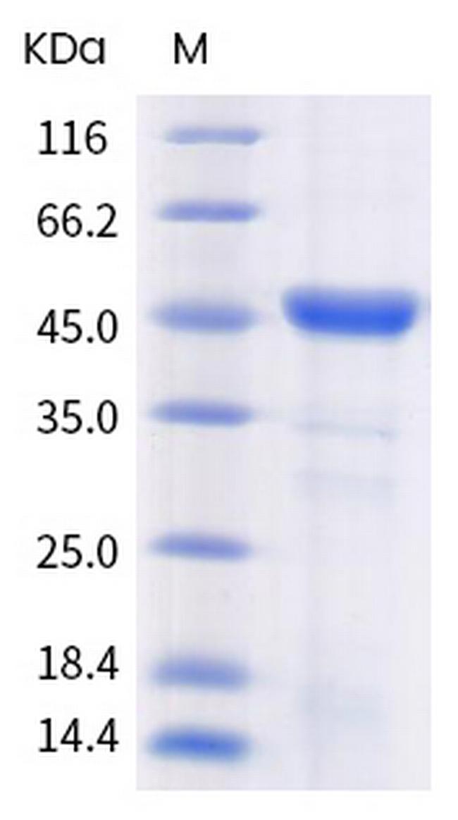 SARS-CoV-2 Envelope Protein (mutant) His-tag Protein