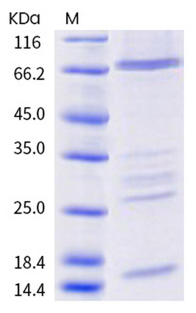 SARS-CoV-2 Helicase His-tag Protein