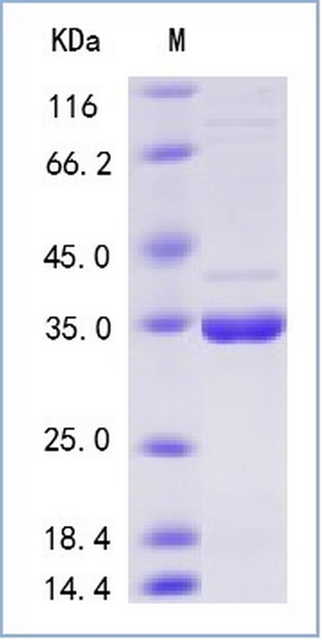 SARS-CoV-2 Methyltransferase His-tag Protein