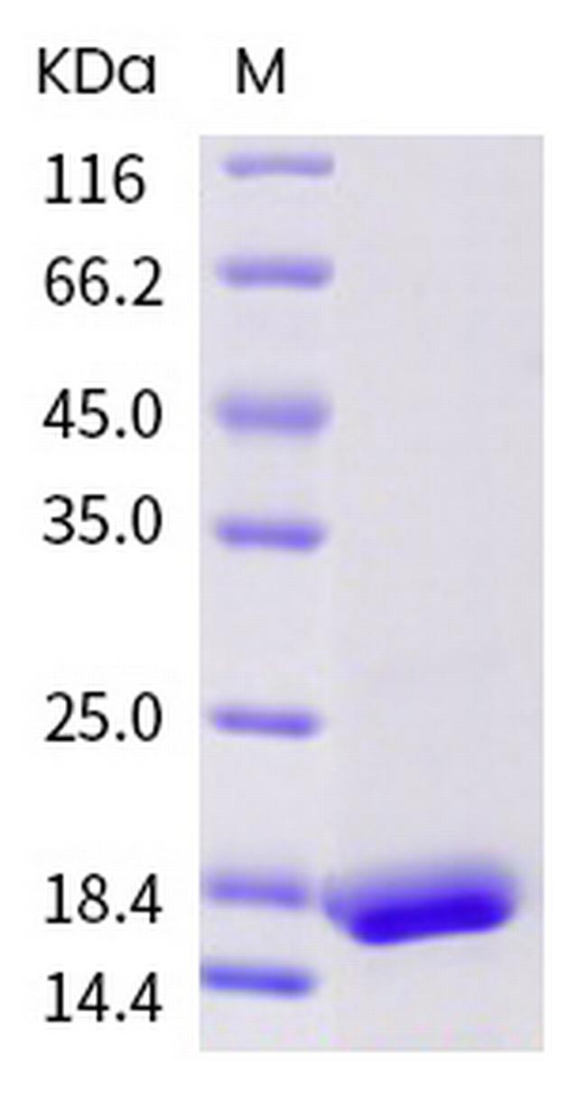 SARS-CoV-2 NSP10 His-tag Protein