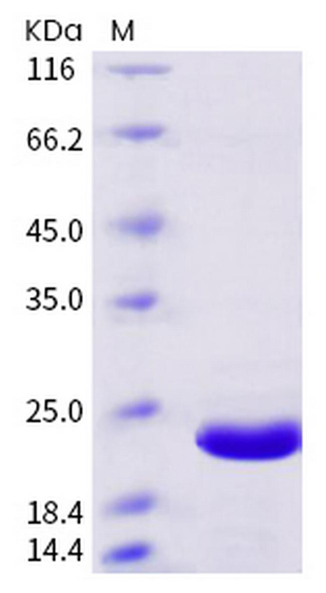 SARS-CoV-2 NSP3 His-tag Protein