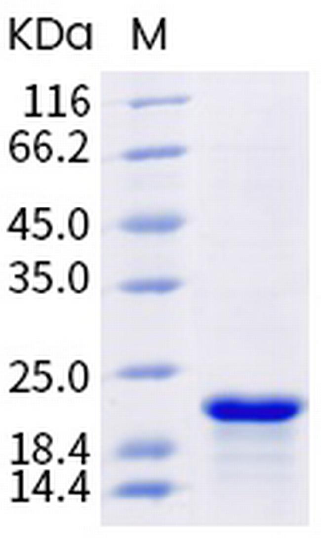 SARS-CoV-2 Nucleocapsid (aa 248-407) His-tag Protein