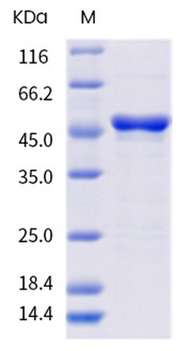 SARS-CoV-2 Nucleocapsid (D377Y) His-tag Protein
