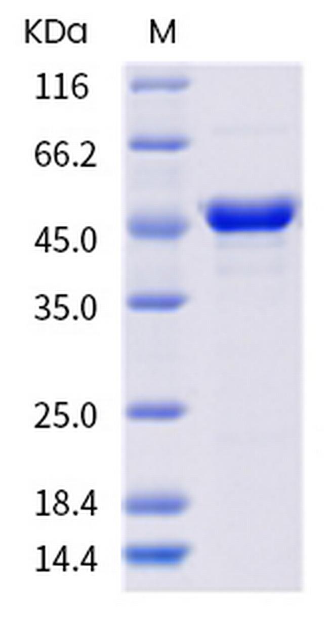 SARS-CoV-2 Nucleocapsid (E378Q) His-tag Protein