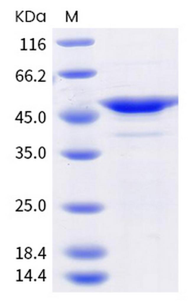 SARS-CoV-2 Nucleocapsid (T205I) His-tag Protein