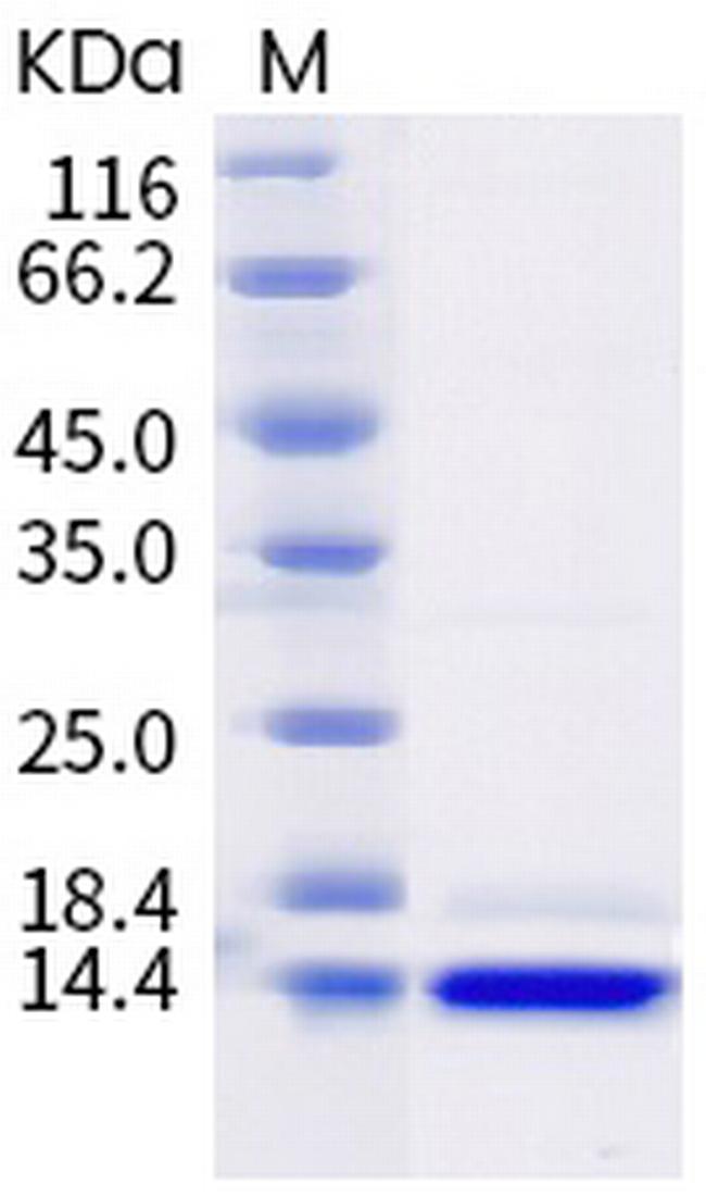 SARS-CoV-2 Nucleocapsid CTD His-tag Protein