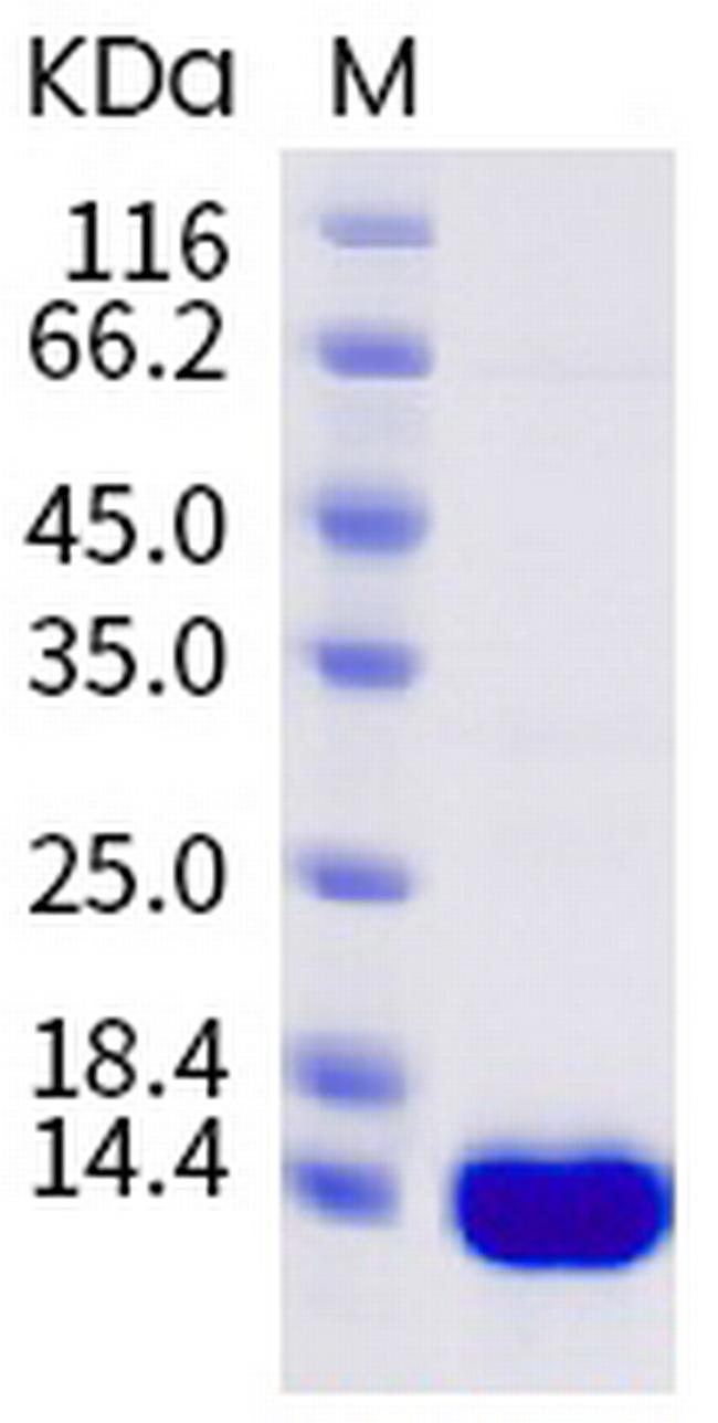 SARS-CoV-2 Nucleocapsid NTD His-tag Protein