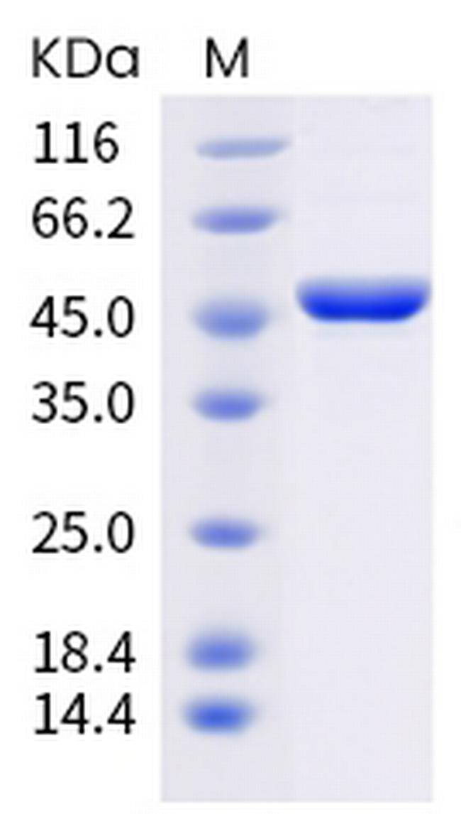 SARS-CoV-2 Nucleocapsid (D3L, S235F) His-tag Protein
